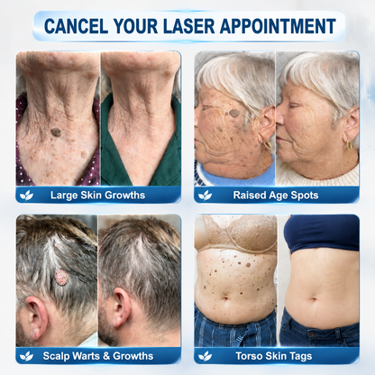 🔥 Last Day 50% OFF –Natravor® 7-𝐃𝐚𝐲 𝐒𝐤𝐢𝐧 𝐓𝐚𝐠 & 𝐒𝐩𝐨𝐭 𝐄𝐫𝐚𝐬𝐞𝐫 𝐂𝐫𝐞𝐚𝐦 (Zero Pain, Zero 𝐒𝐜𝐚𝐫𝐬 Formula) 💎
